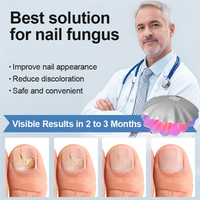 Laser Nail Health Restoring system™